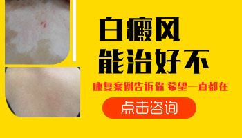 预防护理-白癜风该怎么护理